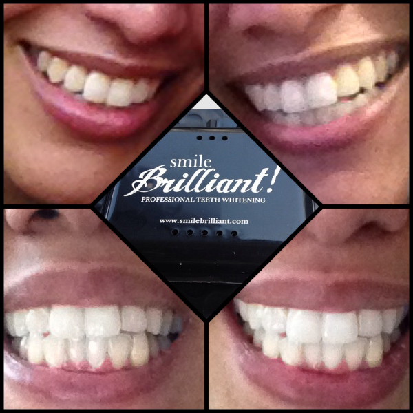 Getting My White Back With Smile Brilliant | MrsTeeLoveLifeLaughter.com